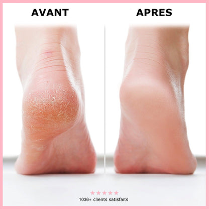 GlowFeet™ | Râpe pour pieds électrique